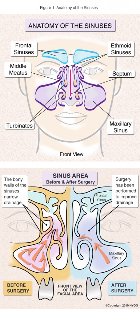 Sinus Anatomy Check Out This Helpful Diagram Ny Sinus Center 3025