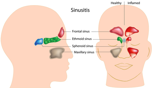 Sinus Cavity Anatomy The Purpose Of The Sinus Cavity